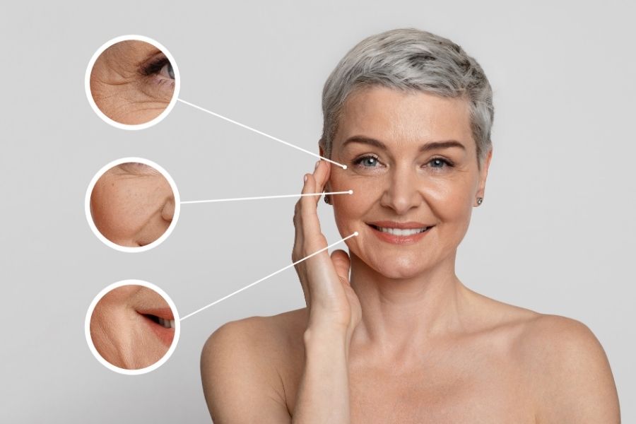 Anti-ageing treatment at Dr. Bhoomi Goel's clinic